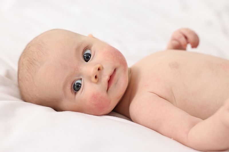 Pipi Kering Bikin Si Kecil Rewel? Atasi dengan Cara Lembut Ini! - Hero Image