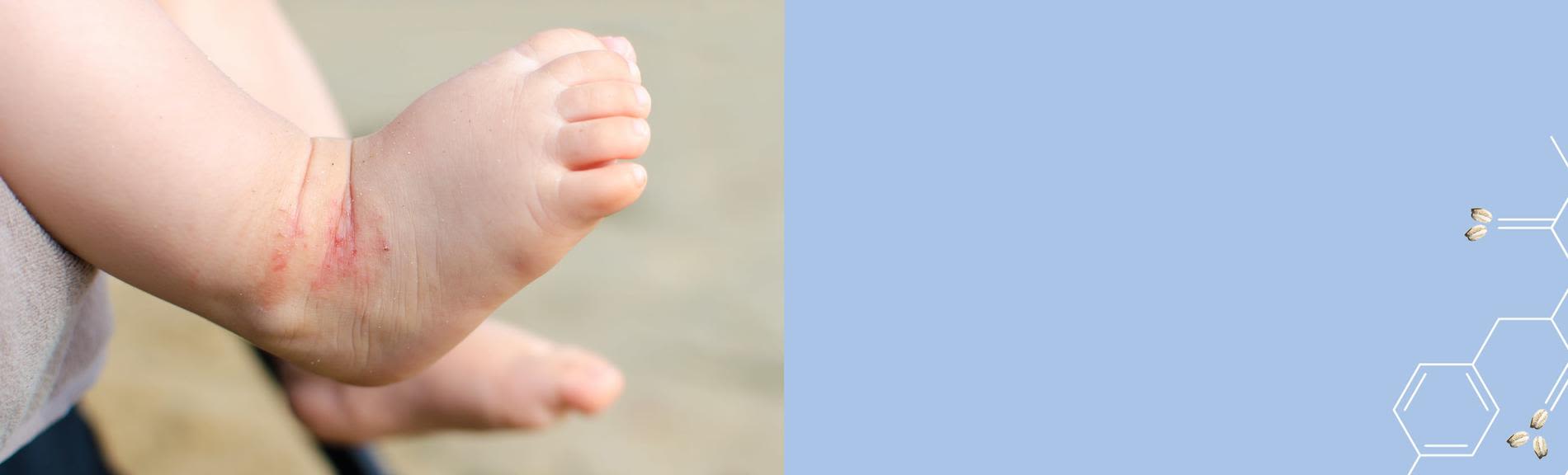 baby-dermexa-moisture_0-en-au