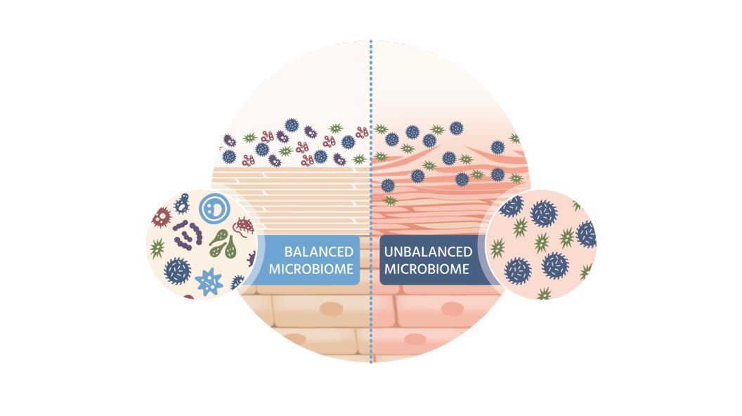 microbiome-illustration2x_0-en-us