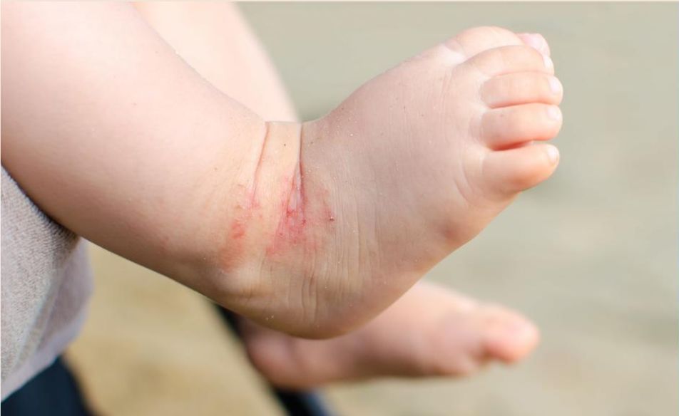 baby-ezmoa