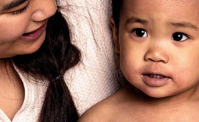 Woman smiling toward baby, baby appears to have skin condition above lips and on cheeks