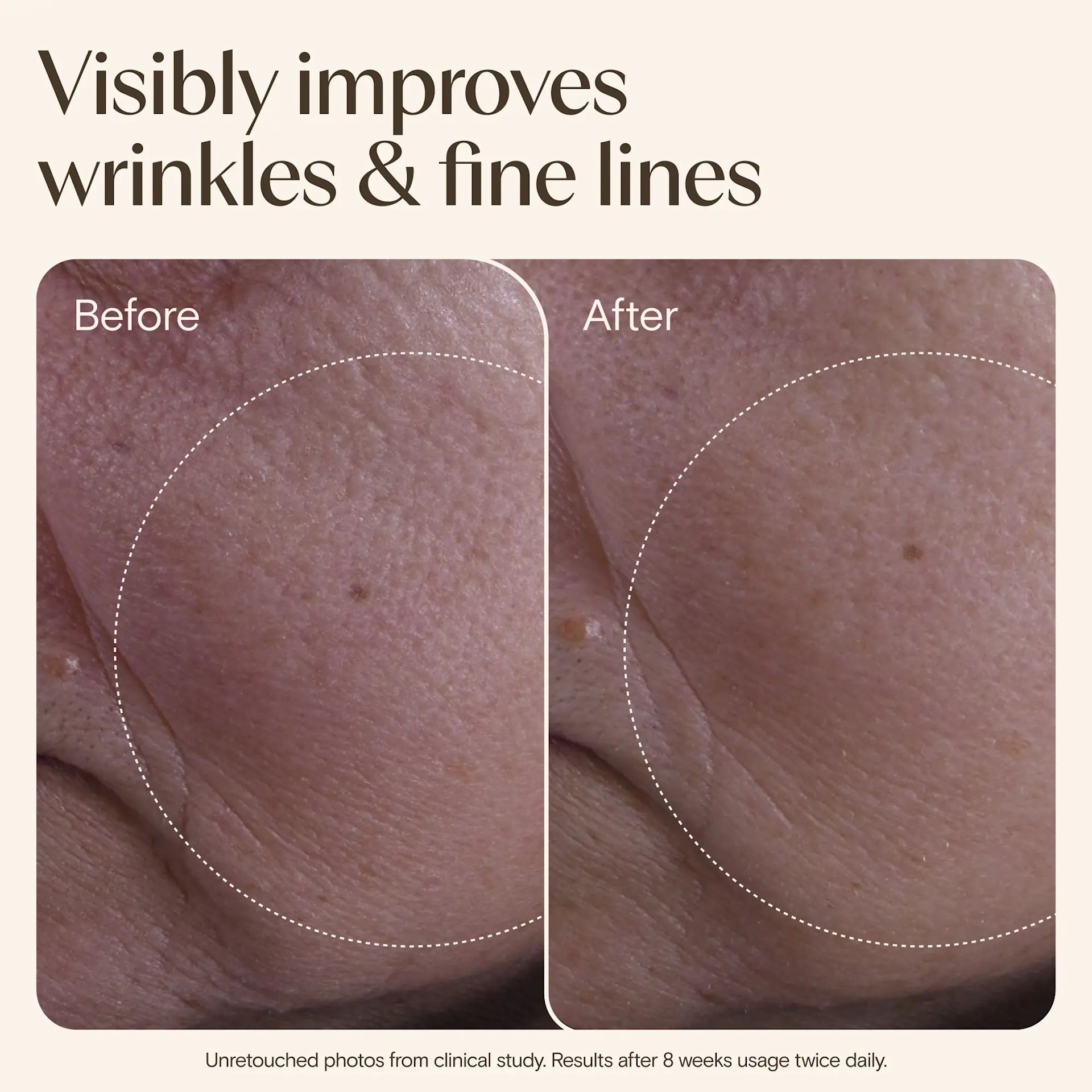 Age_Renewal_Face_Cream_50m-image8