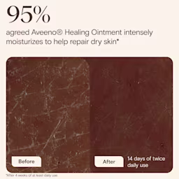 JS 4737 AVE Healing Ointment Enhanced Content EC Image Adaptation 3000x3000 ENG-F-06 JS 4737 AVE Healing Ointment Enhanced Content EC Image Adaptation 3000x3000 ENG-F-06