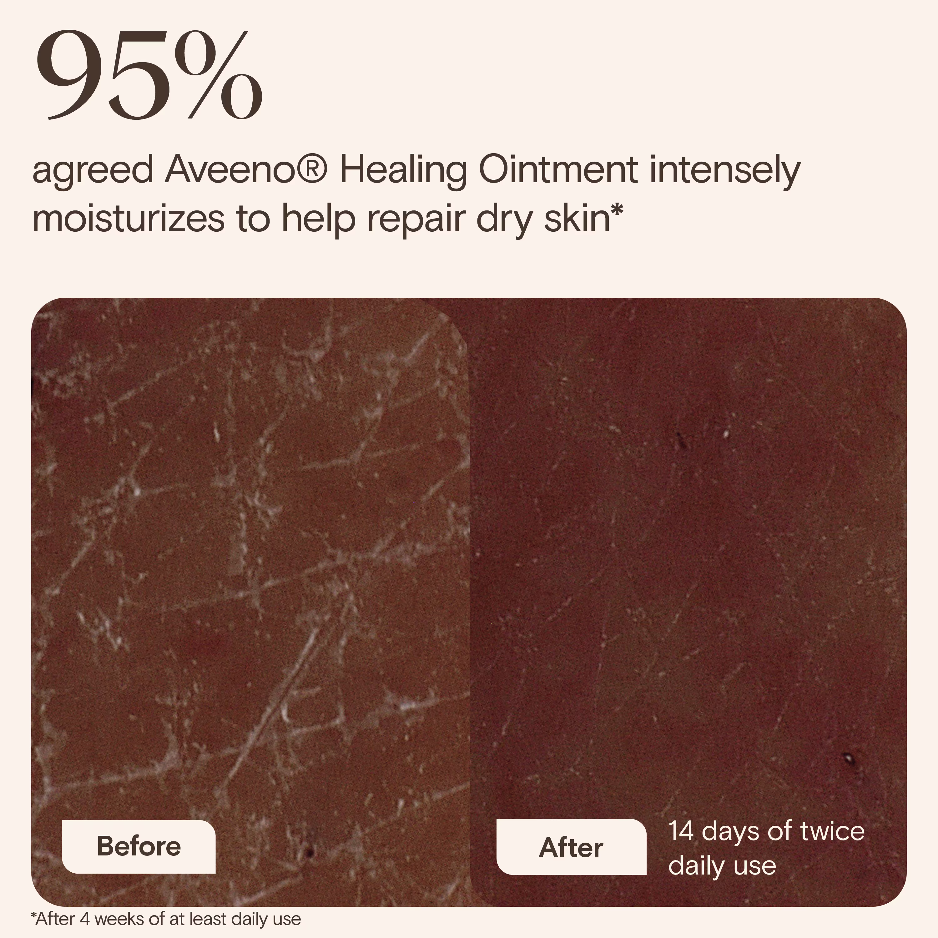 JS 4737 AVE Healing Ointment Enhanced Content EC Image Adaptation 3000x3000 ENG-F-06 JS 4737 AVE Healing Ointment Enhanced Content EC Image Adaptation 3000x3000 ENG-F-06