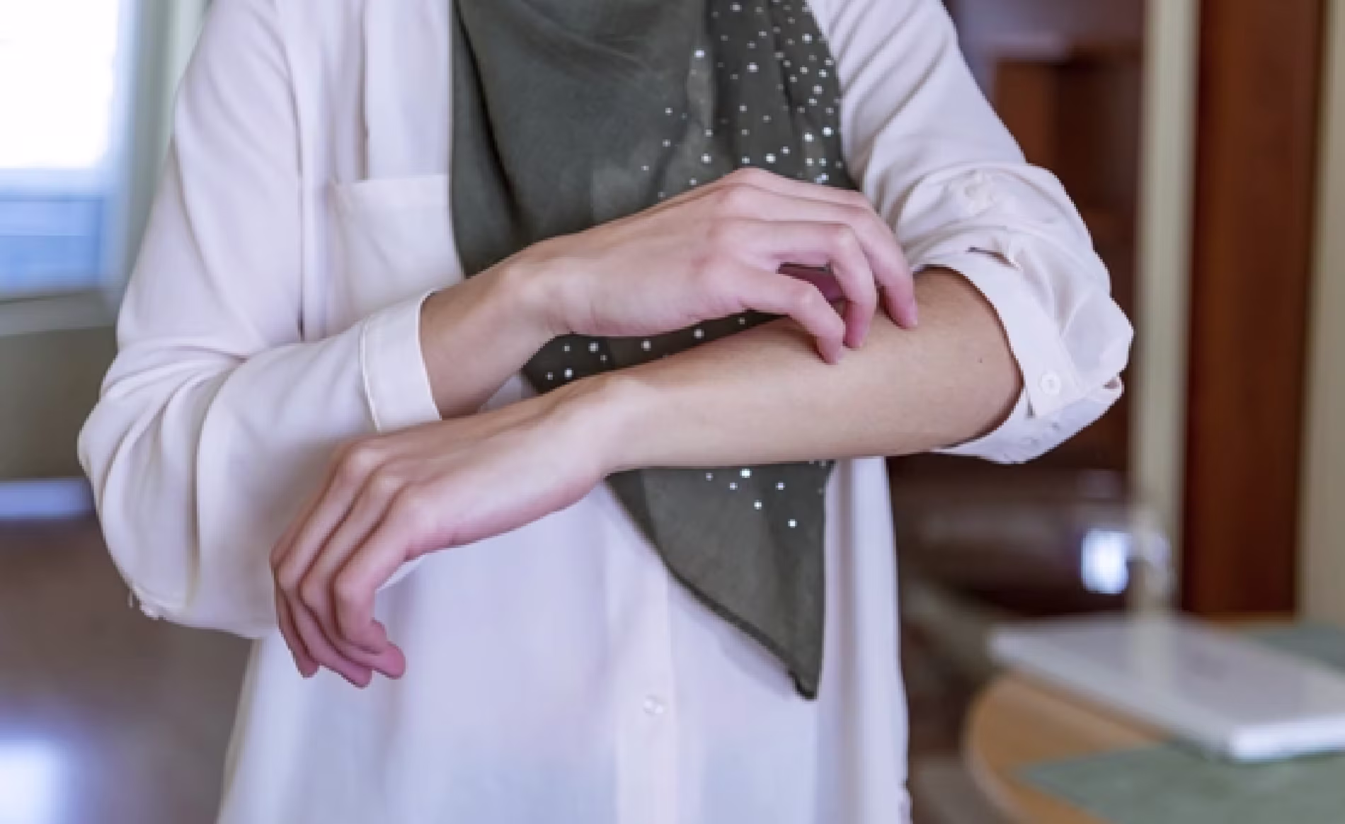 A Woman in a white shirt is scratching her left arm, showing a condition of itching skin irritation