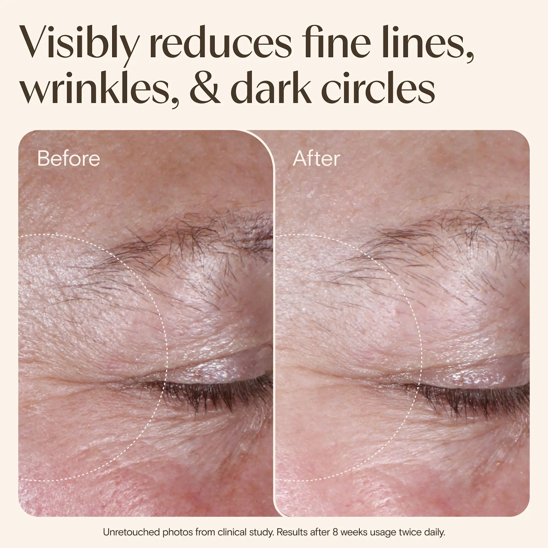 Age Renewal Eye Gel Cream - Image 7