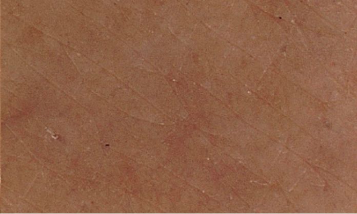 Aveeno® Skin Relief Healing Ointment card highlighting After 14 days use Skin condition