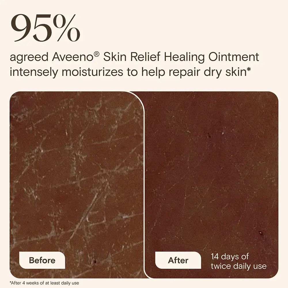 95% agreed Aveeno® Skin Relief healing ointment intensely moisturizes