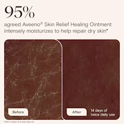 NA-US-Aveeno-SkinRelief-HealingOintment-7oz-BA-ATF6-Amazon-3000x3000 Original file 95% agreed Aveeno® Skin Relief healing ointment intensely moisturizes