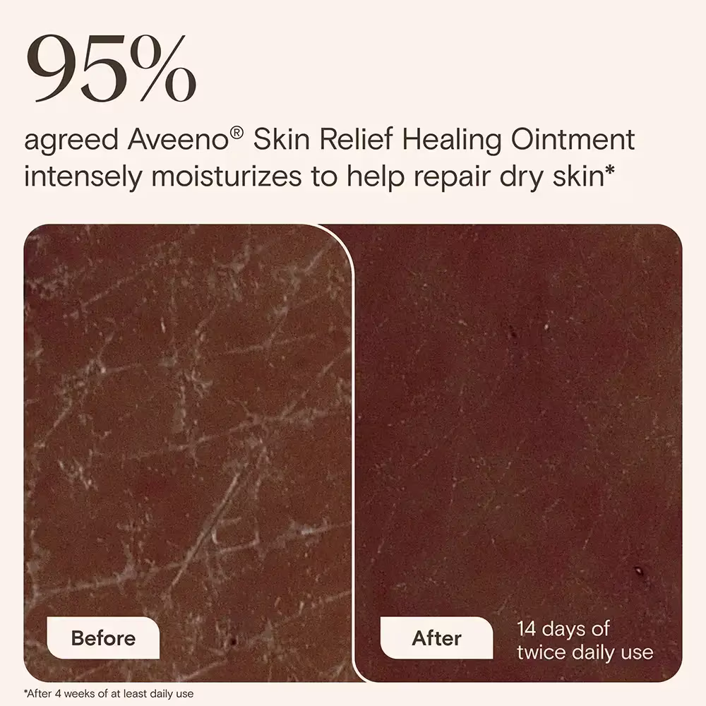 NA-US-Aveeno-SkinRelief-HealingOintment-7oz-BA-ATF6-Amazon-3000x3000 Original file 95% agreed Aveeno® Skin Relief healing ointment intensely moisturizes