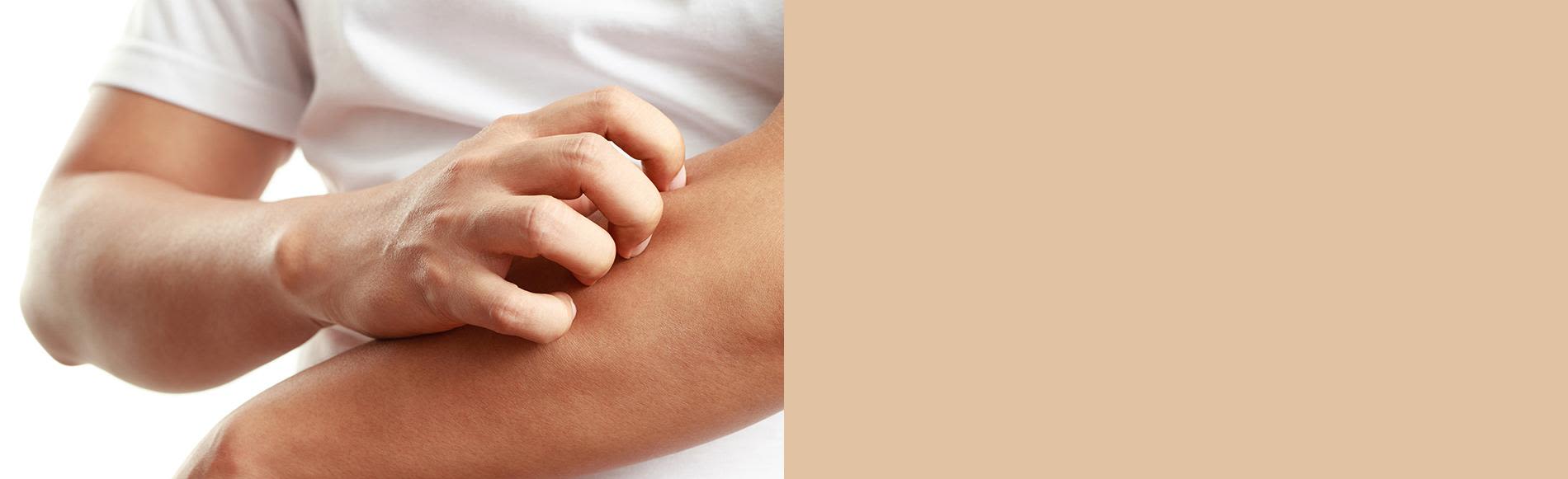 aveeno_body_itchy_skin_banner-en-au