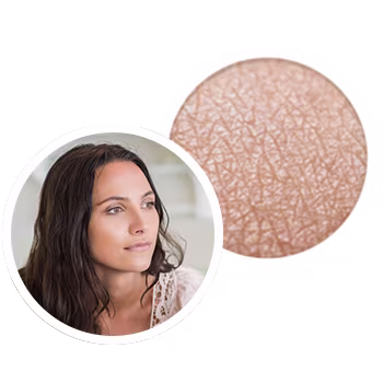 what-is-eczema