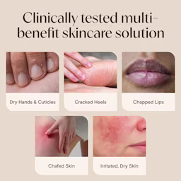 NA-US-Aveeno-SkinRelief-HealingOintment-7oz-Usage-ATF8-Amazon-3000x3000 Original file Clinically tested multi benefit skincare solution