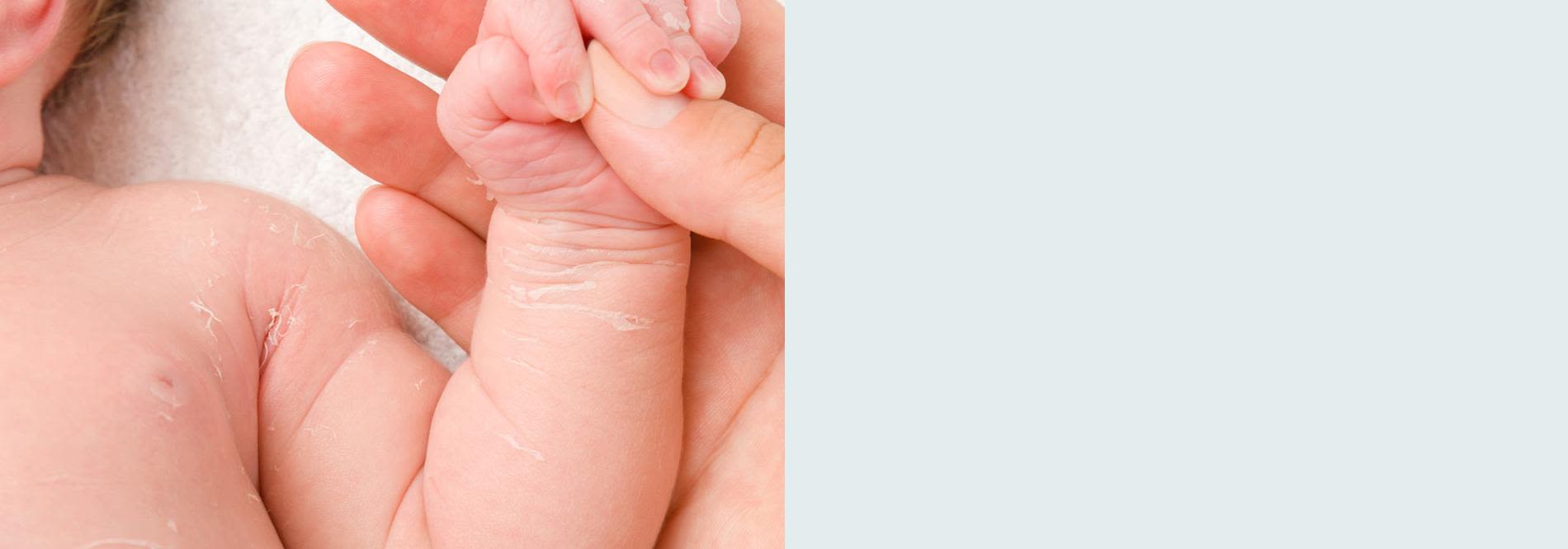 banner_-_dry_itchy_skin-en-au