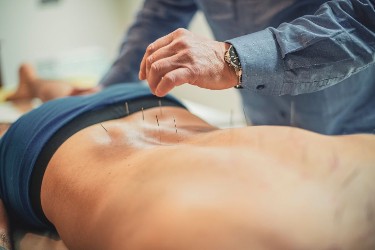 Young male having acupuncture treatment, one of the many benefits of private health insurance