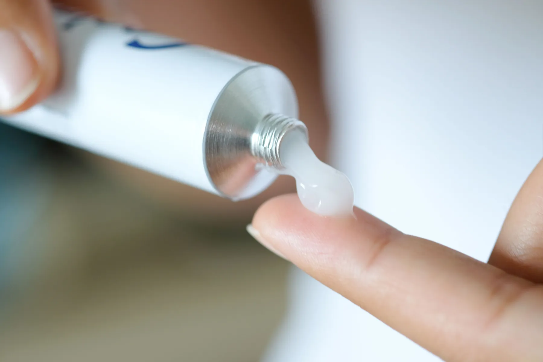 A cream or ointment being squeezed out of a white tube onto a woman's finger for fungal acne treatment. 