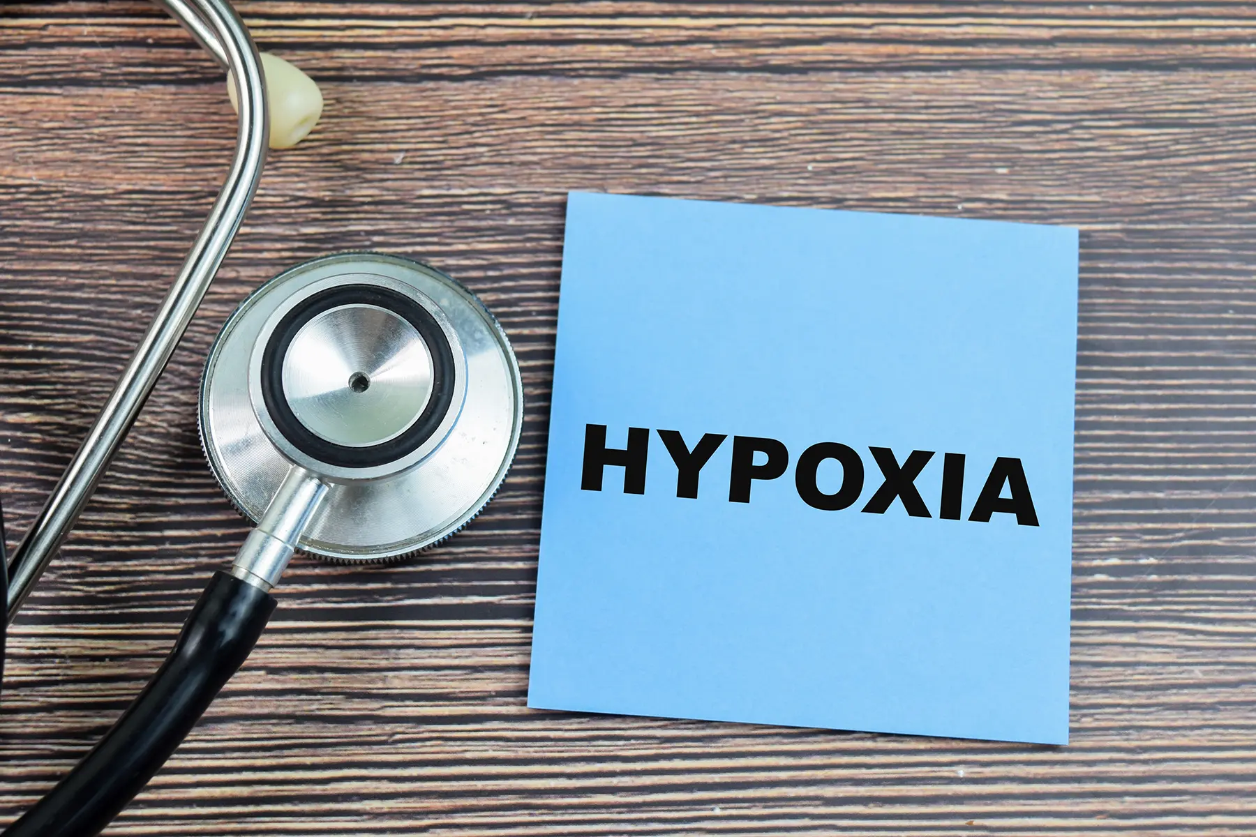 Hypoxia written on a Post-it, next to a stethoscope