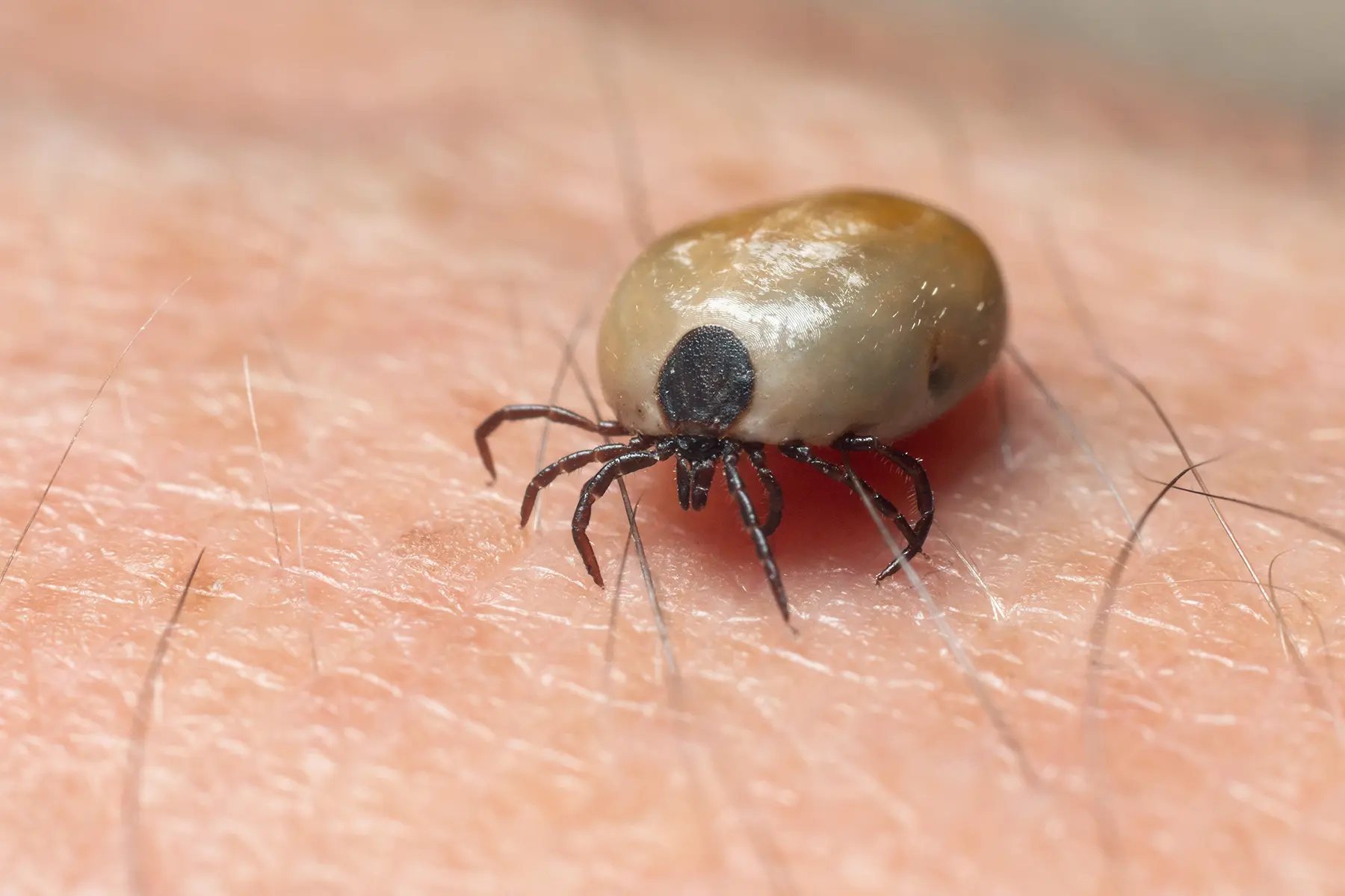 Tick on skin