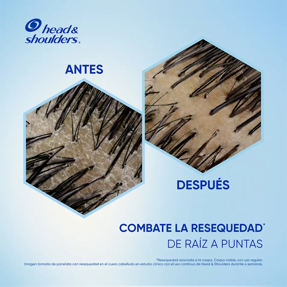Head & Shoulders ha desarrollado la fórmula más nutritiva de su portafolio que nutre, retiene la hidratación y elimina la caspa del cuero cabelludo seco. Head & Shoulders ha desarrollado la fórmula más nutritiva de su portafolio que nutre, retiene la hidratación y elimina la caspa del cuero cabelludo seco.