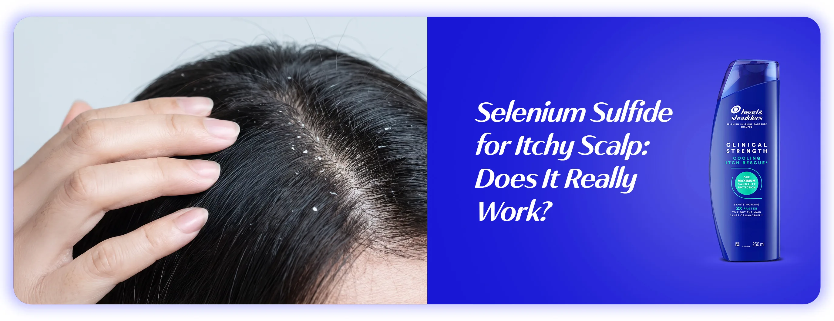 Discover whether selenium sulfide shampoo works for itchy scalp and severe dandruff by helping control flakes and scalp.