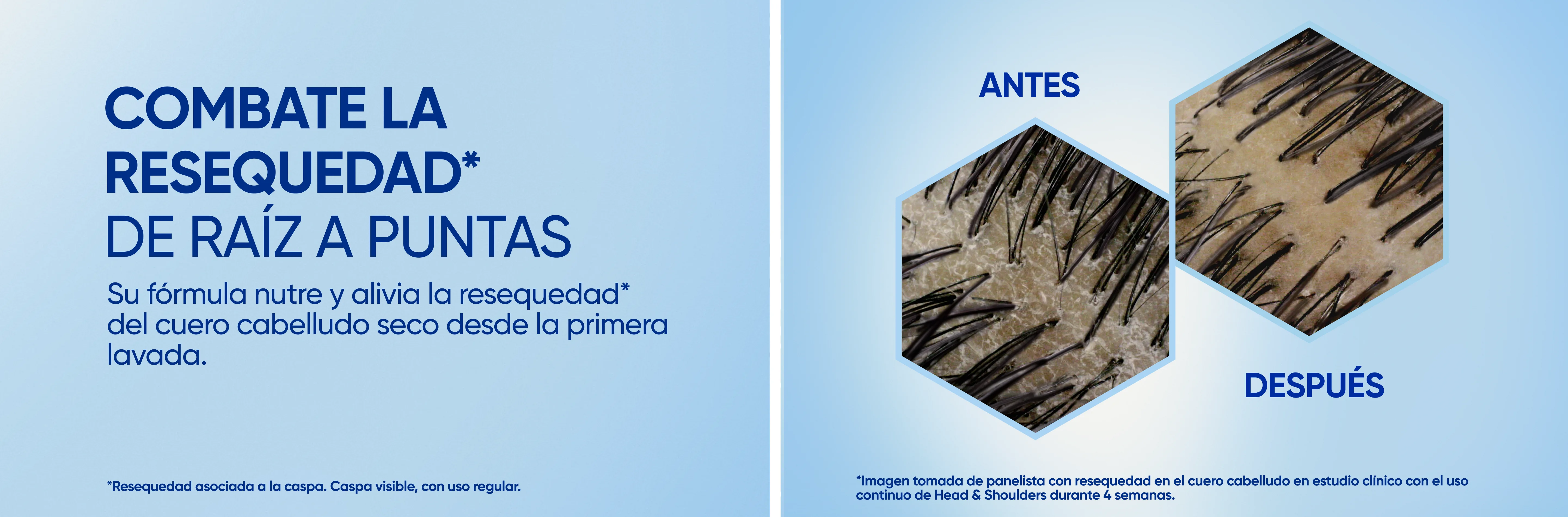Comparativa antes y después de cuero cabelludo con resequedad sobre fondo azul claro, con texto "Combate la resequedad de raíz a puntas: Su fórmula nutre y alivia la resequedad del cuero cabelludo seco desde la primera lavada"