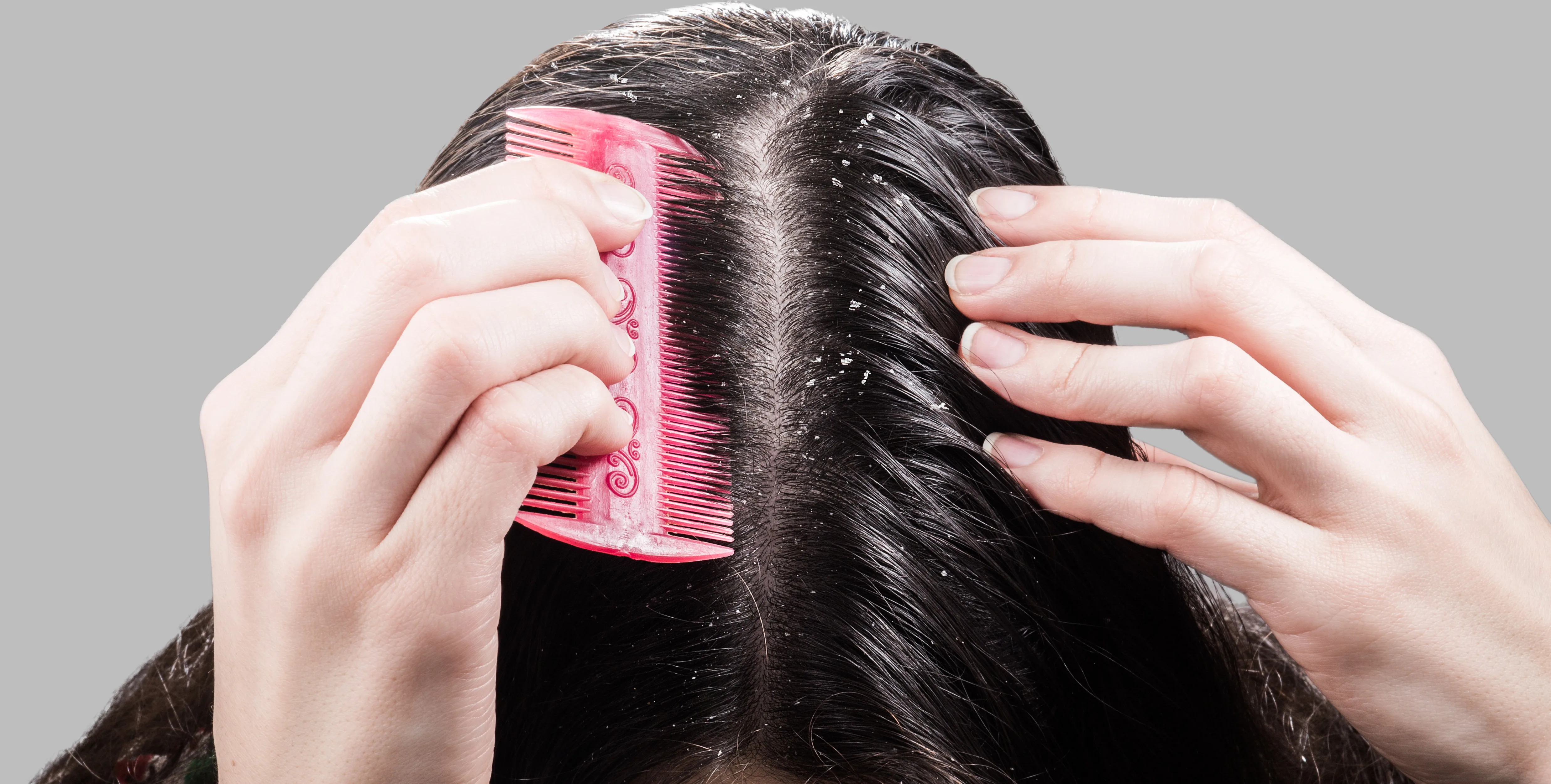Woman Combing for Dandruff