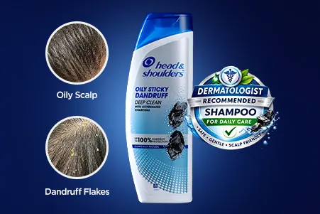 A visual showing an oily scalp with flakes and a dermatologist-recommended shampoo for daily care.