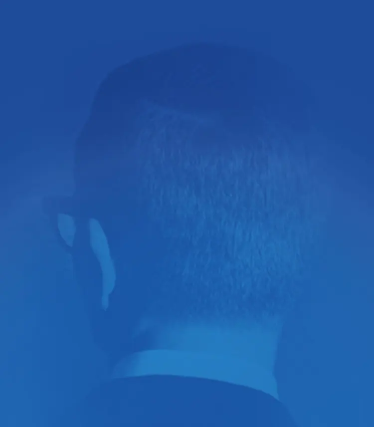 Scalp