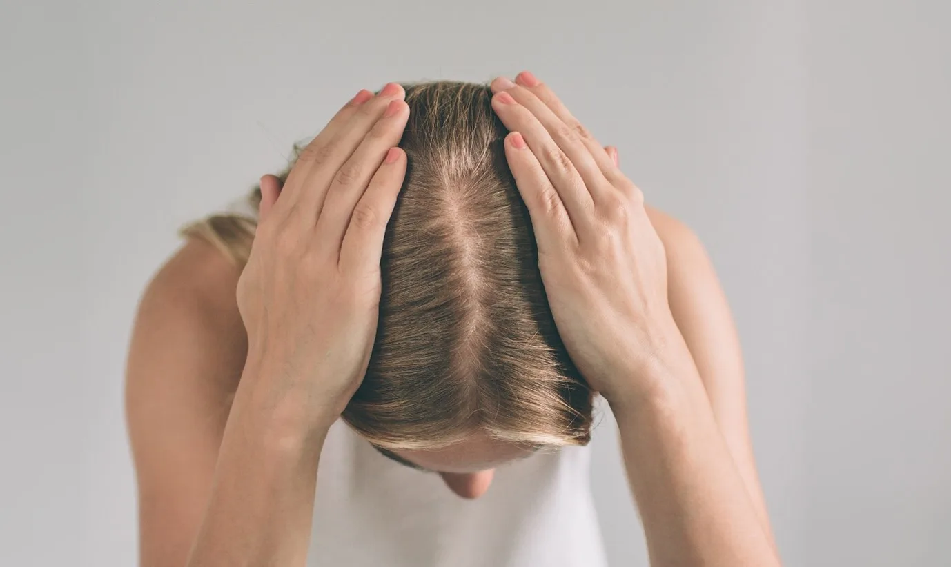 Scalp Folliculitis
