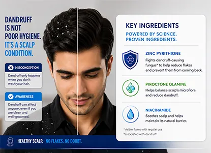 Dandruff is not just about hygiene, understanding scalp causes and choosing the right shampoo ingredients helps reduce flakes