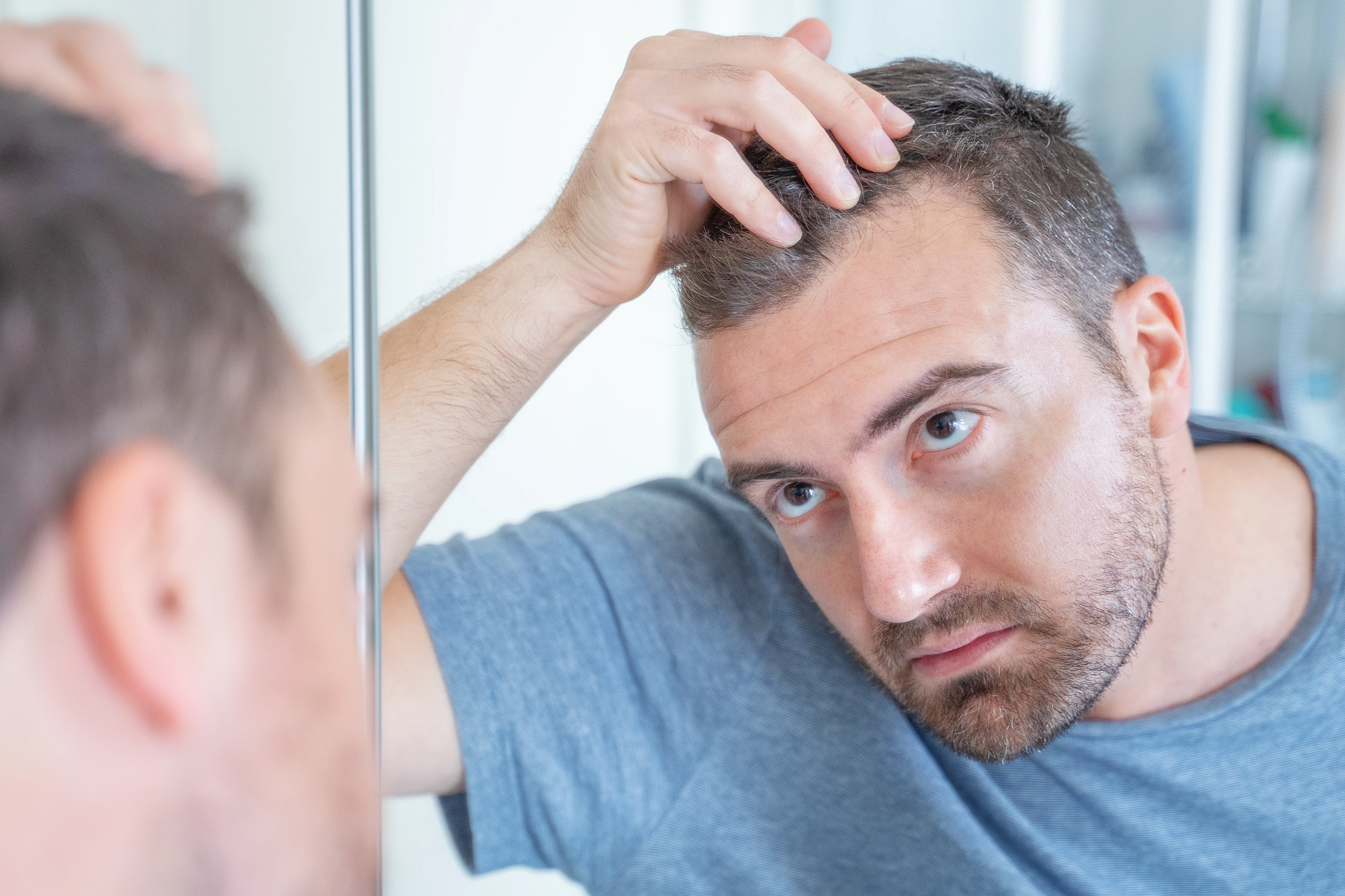 scalp sporiasis