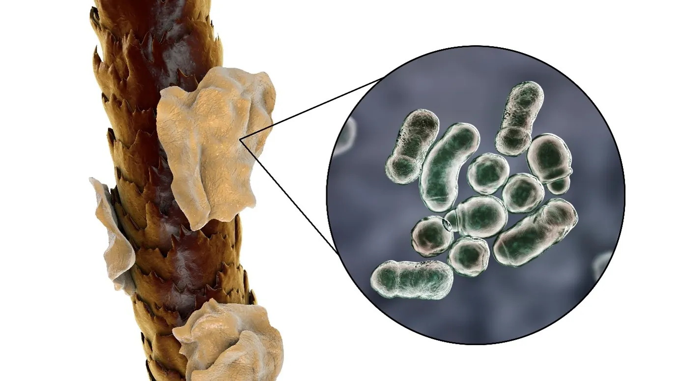 Dandruff causing fungus