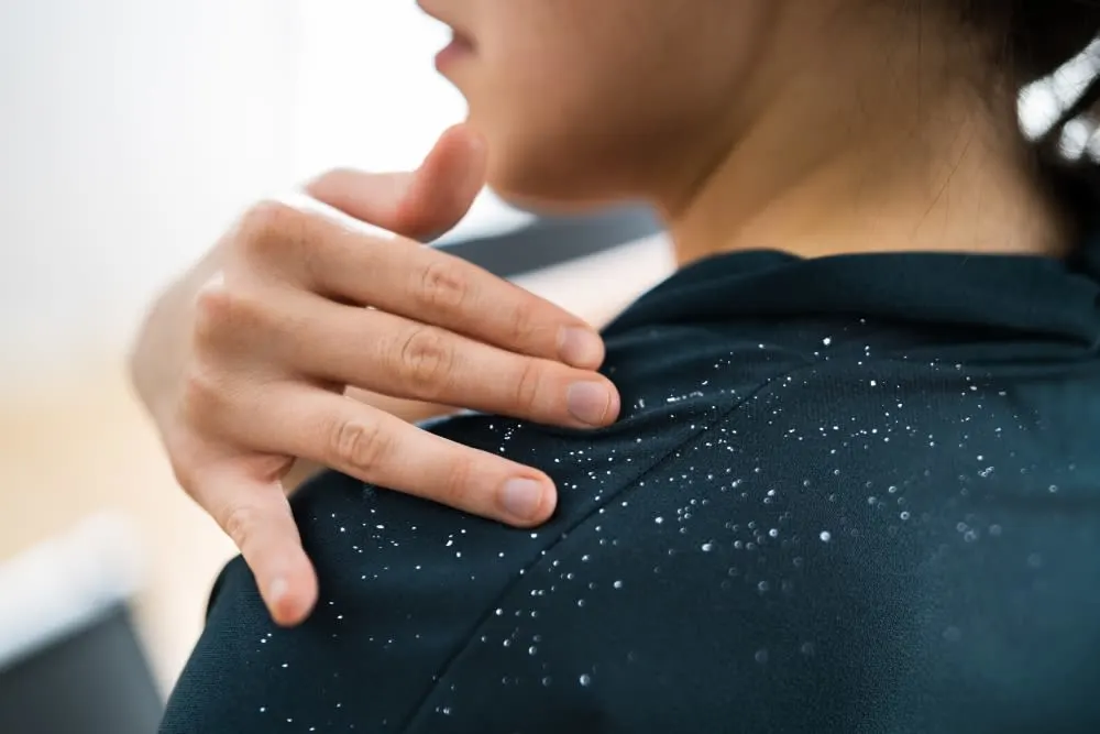 8 Dandruff Shampoos To Help You Treat Your Dandruff