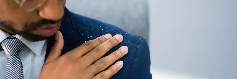 How Stress Can Aggravate Dandruff