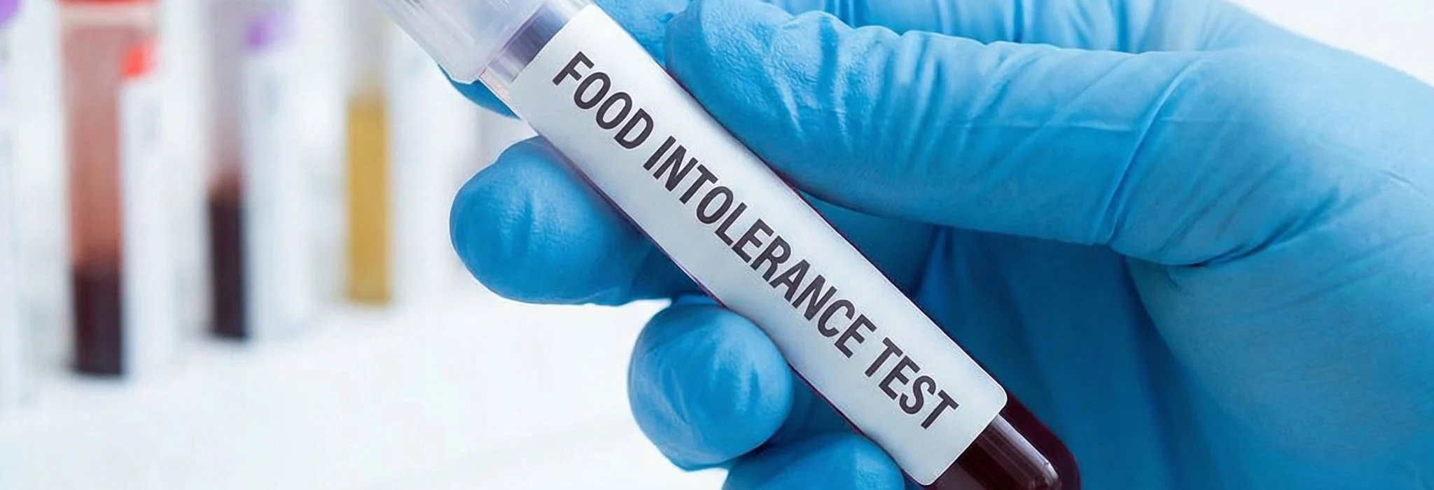 IMG categoria Intolleranze e salute intestinale