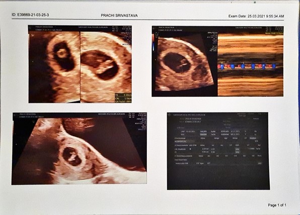Ultrasound report of baby 2