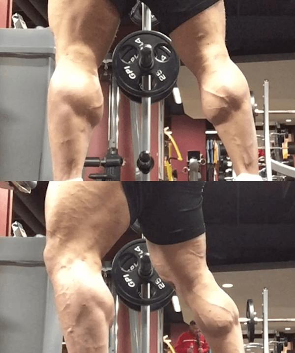 マイクイズラテルのふくらはぎ