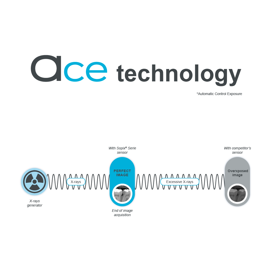 The ACE technology