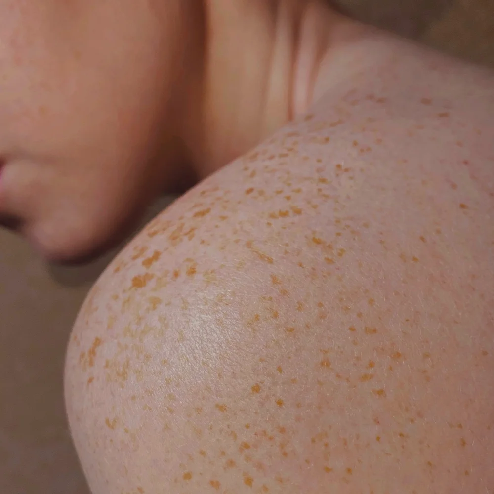 Skin, the body’s largest organ: layers, functions, and conditions - Desktop Image