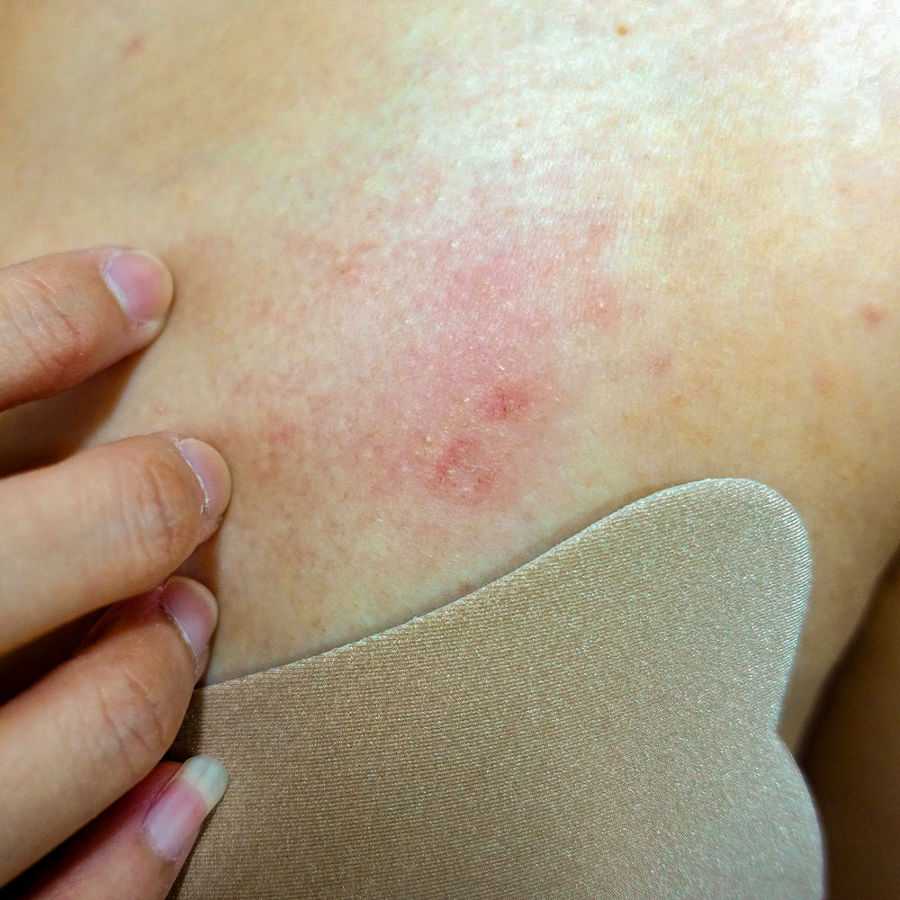 Common Skin Conditions & Rashes in Children: Causes & Treatment