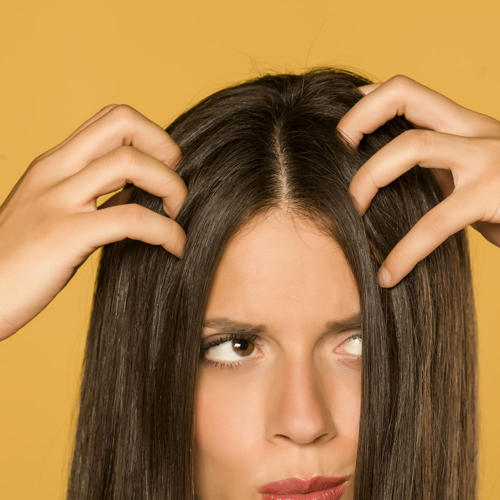 Can Apple Cider Vinegar Help With Dandruff? Ro