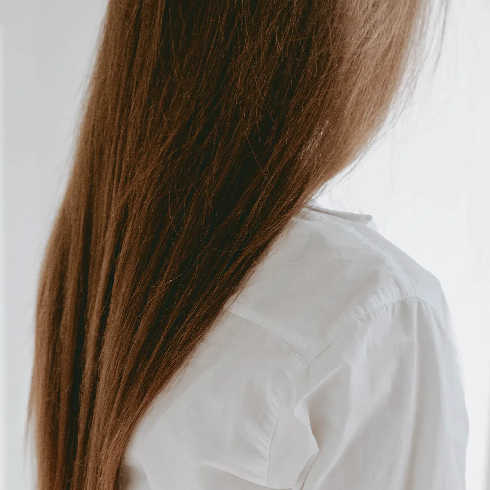 Dandruff: symptoms, causes, treatment, prevention - Desktop Image