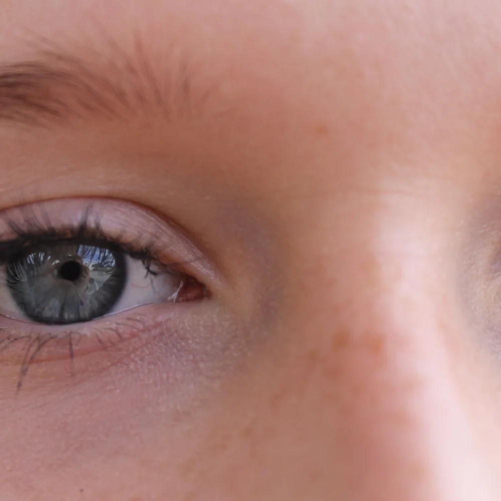 Eyelash mites: what are they, symptoms, treatments - Desktop Image