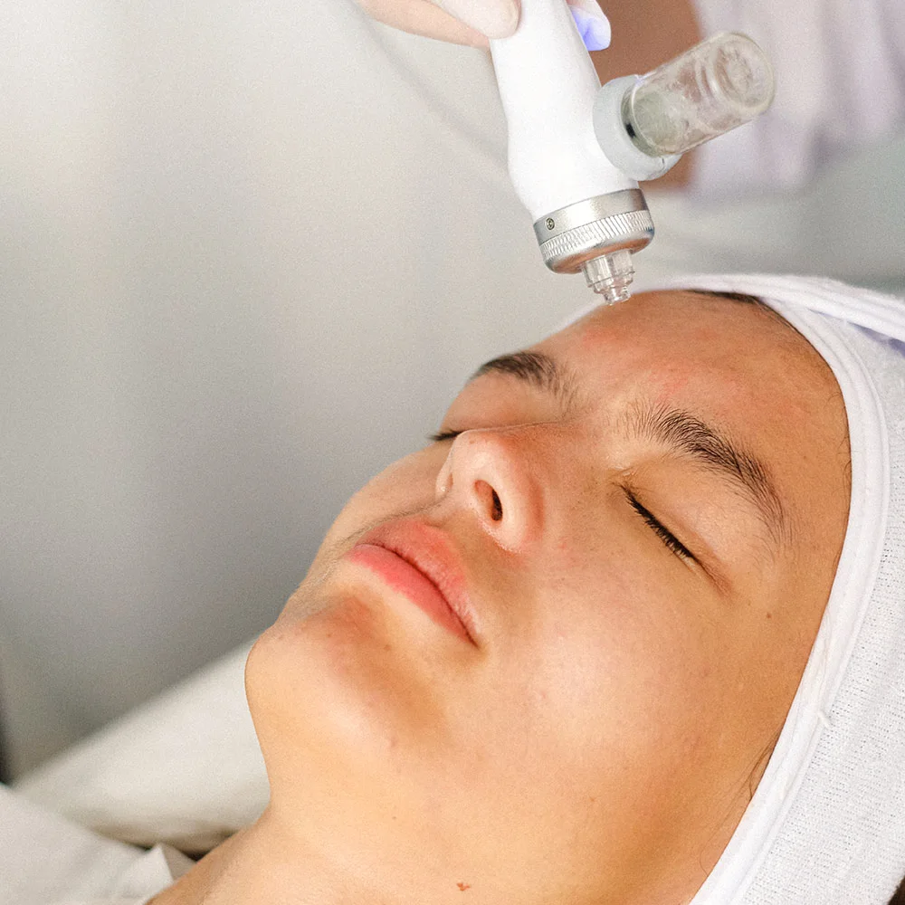 Collagen induction therapy or microneedling for skin quality - Desktop Image