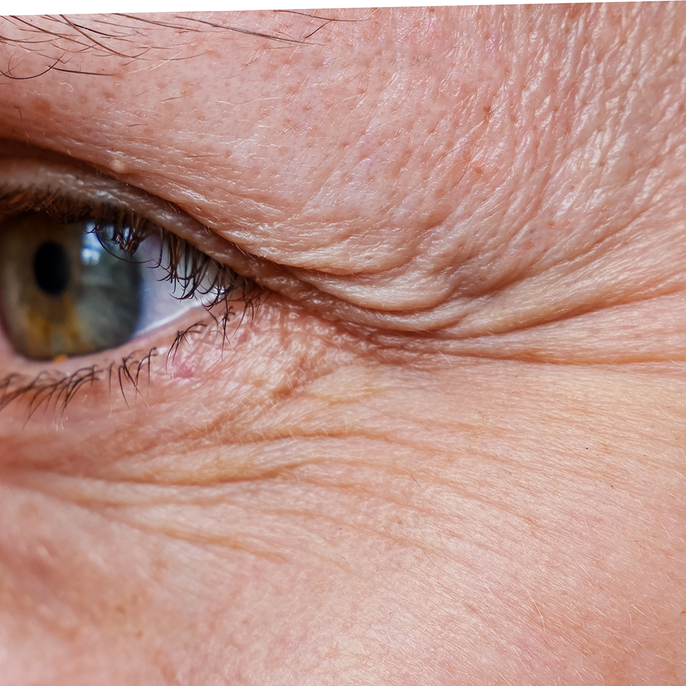 How to Get Rid of Wrinkles: 12 Wrinkle Removing Options Ro How to Get Rid of Wrinkles: 12 Wrinkle Removing Options Ro