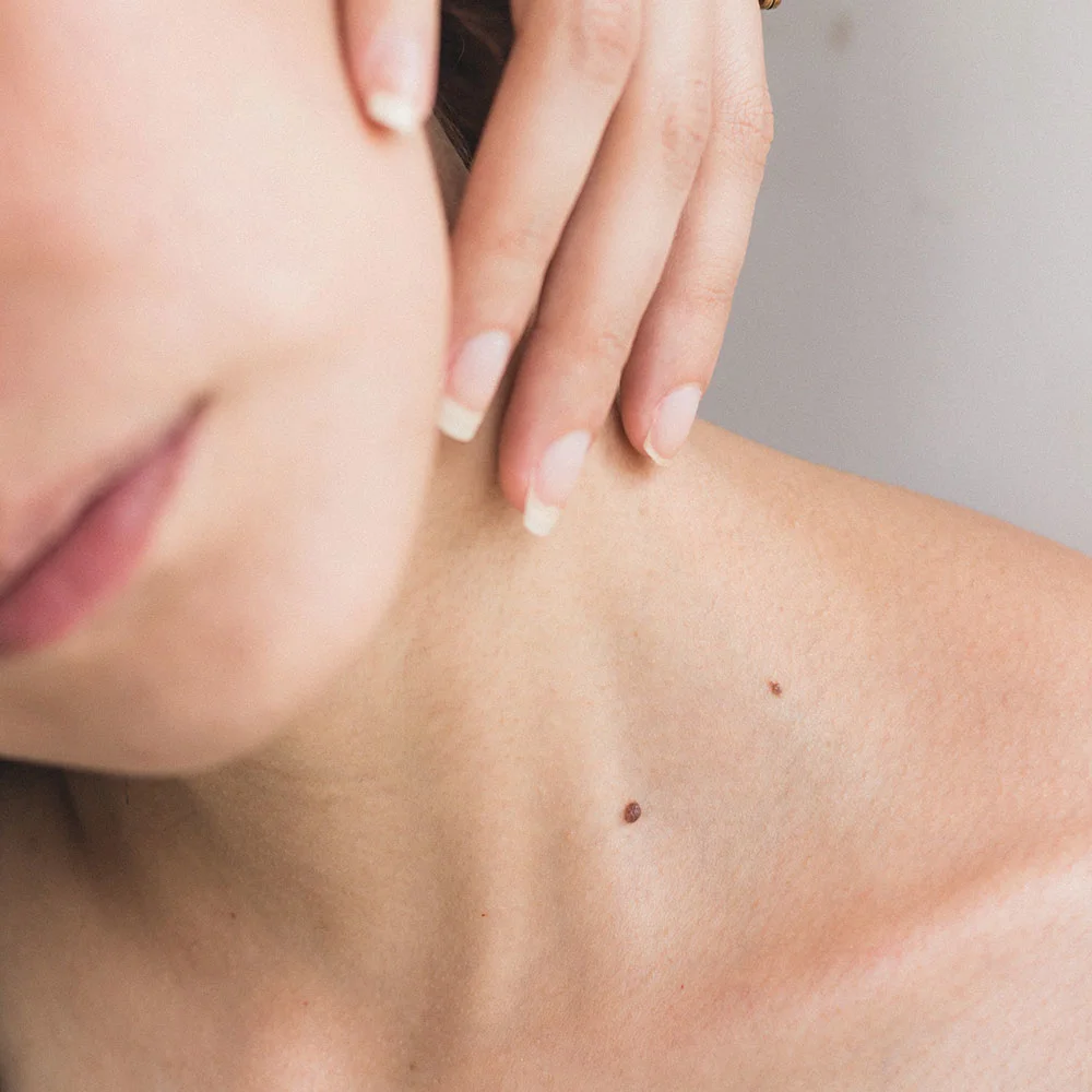 Skin tightening: 6 treatments and procedures - Desktop Image