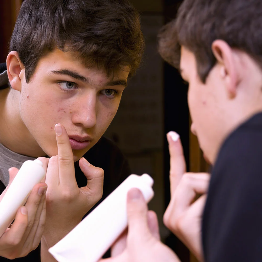 Clindamycin for acne: what is it, benefits, side effects - Desktop Image