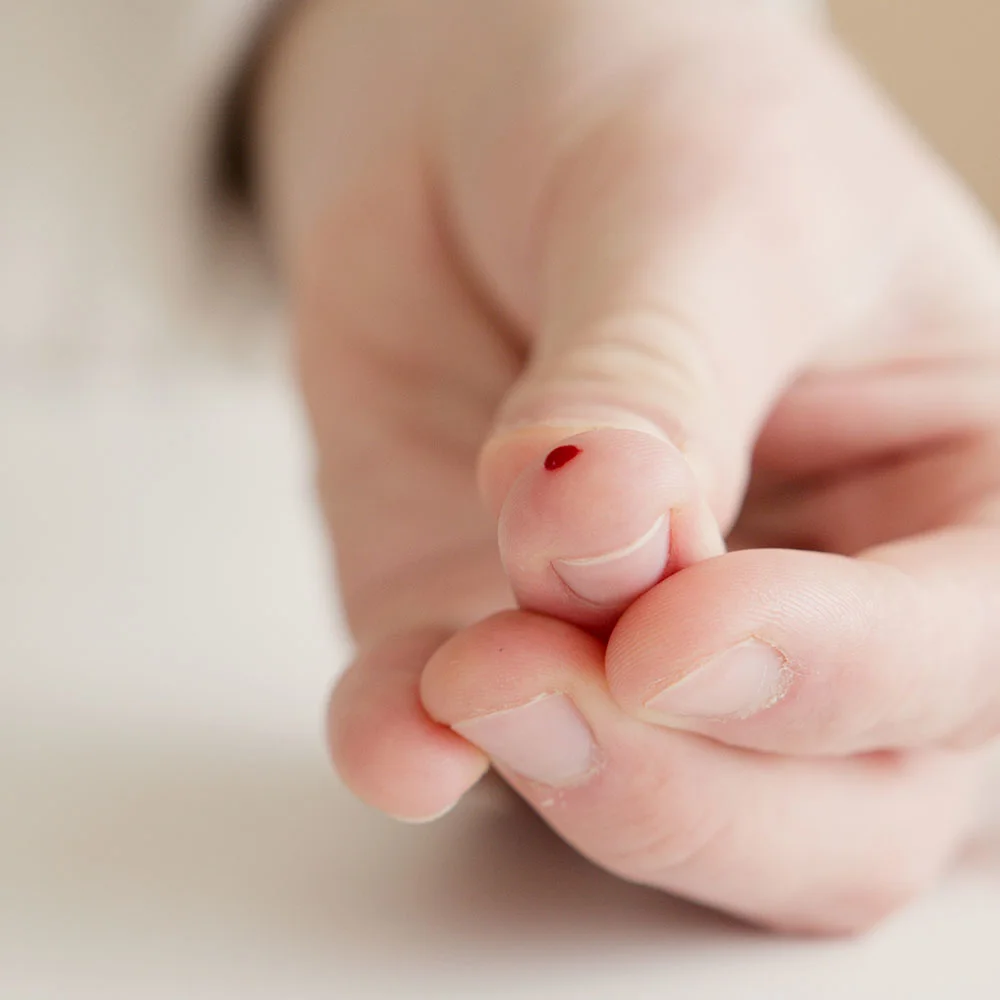 Type 1 diabetes: causes, symptoms, diagnosis, and  treatment - Desktop Image