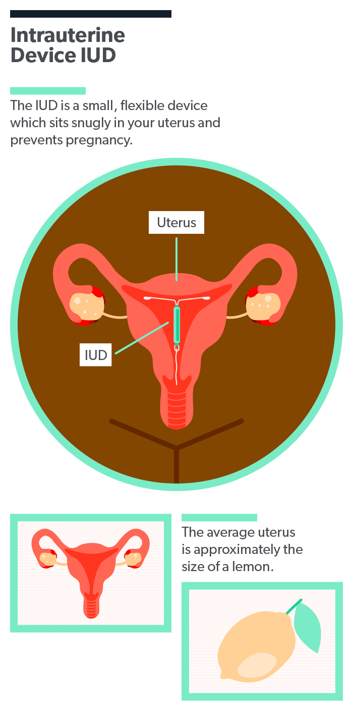 IUDs And Fibroids: Which Contraceptive Is Best For Fibroids?