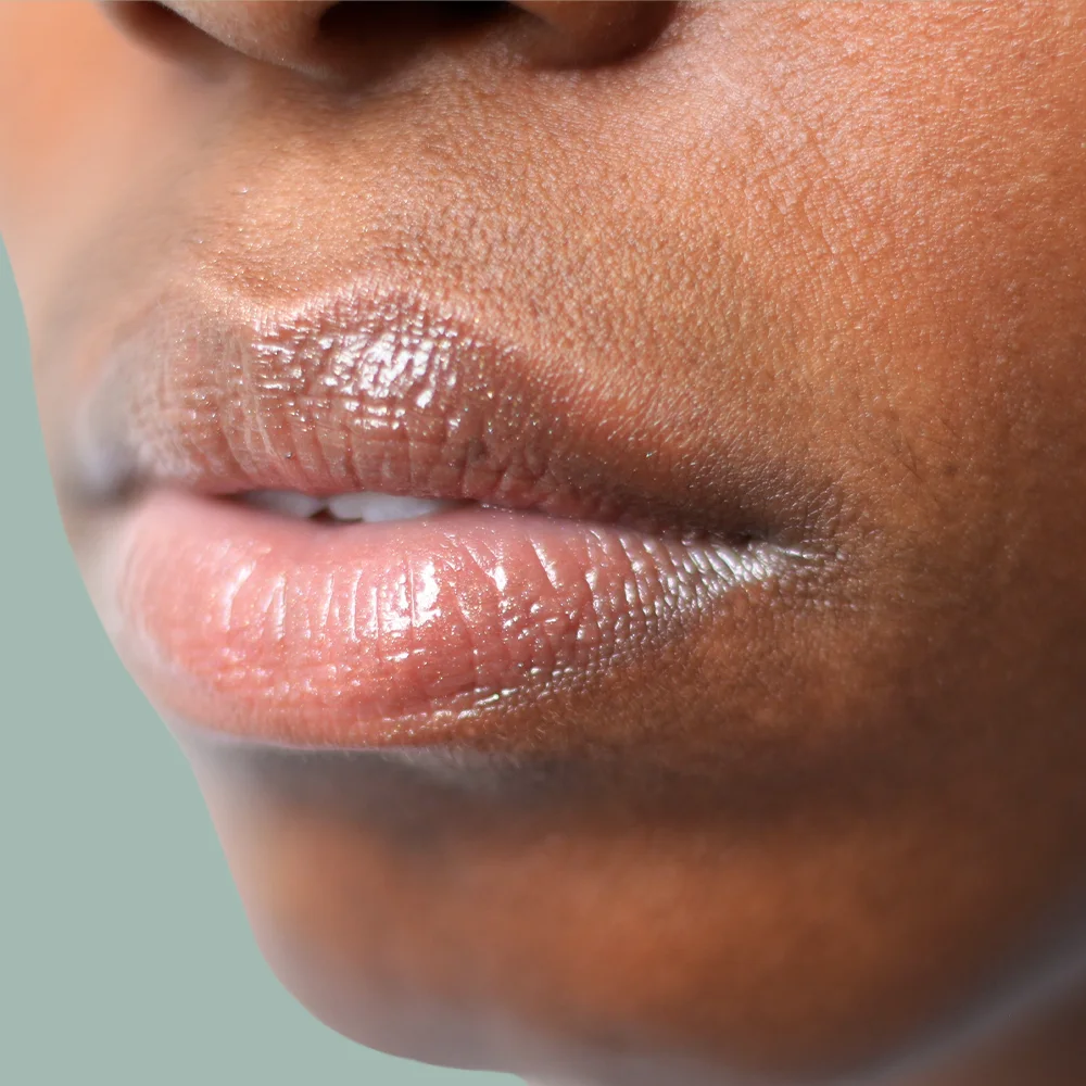 How to get rid of herpes symptoms - Desktop Image